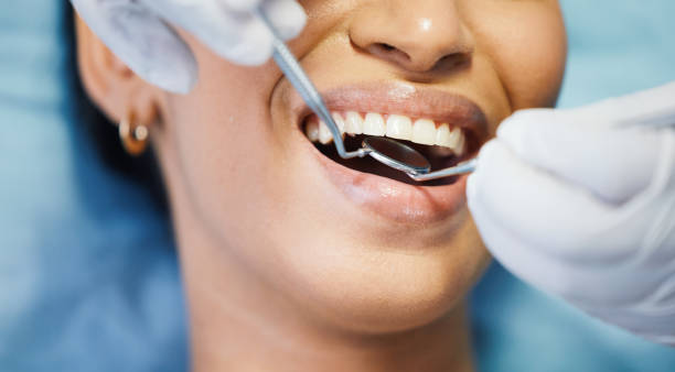 Best Emergency Broken Tooth Repair in Town And Country, WA