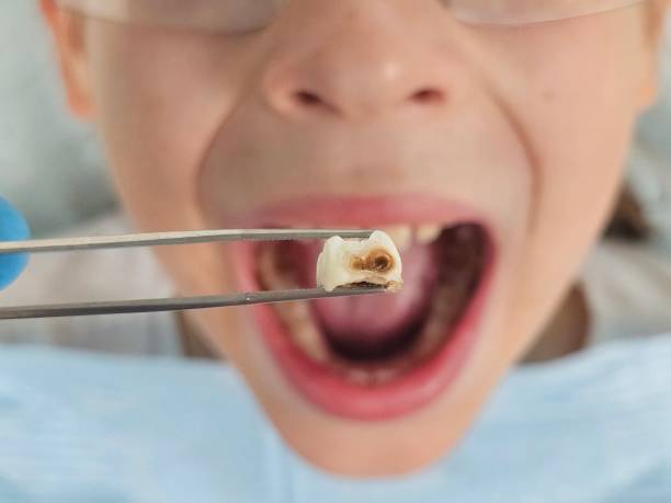 Best Pediatric Emergency Dentist in Town And Country, WA